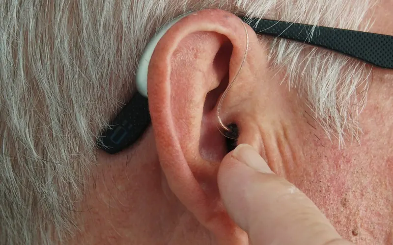 Reclamación de seguro: Rechazo de implantes cocleares